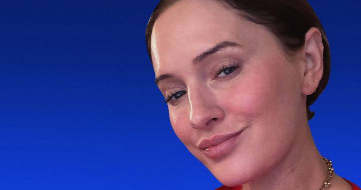 Sofie Pavitt: I Got a Neck-Lift at 41 Years Old: Review