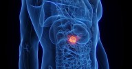 Major cancer breakthrough as lifestyle choice tied with deadly disease