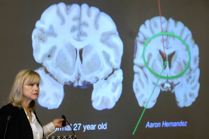 Shooter who targeted NFL headquarters diagnosed with CTE after death