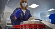 La tuberculosis cambia de ciclo en Andalucía y suma tres años creciendo el contagio