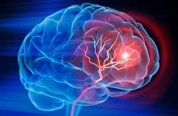 Stem Cell Transplant in Mice Makes Stroke Recovery Possible