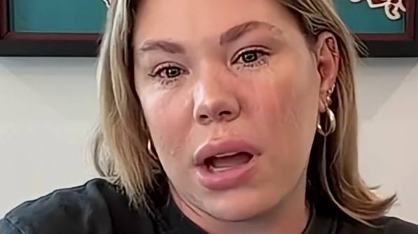 Kailyn Lowry Admits Her Plastic Surgery is 'F-
