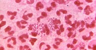The part of Leicestershire with the highest number of biblical STI infections revealed