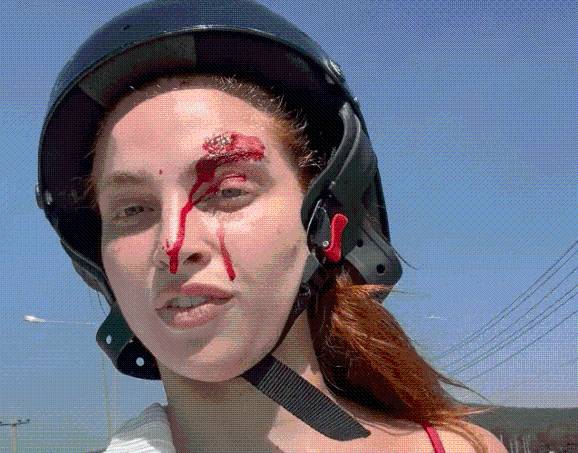 Love Island star, 24, in horror motorbike crash in Thailand leaving her with bloody wounds and ‘skin stripped off’