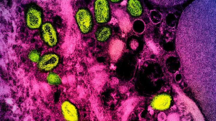 Feds Suspiciously Revive the Name 'Monkeypox' After Dropping It in 2022