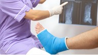 Descubrimiento histórico: Científicos chinos crean Bone 02, un gel que repara fracturas en 3 minutos
