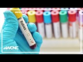 Bat tests positive for rabies in Matthews