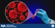 Se diagnostican más de tres casos de mieloma múltiple por día en la Argentina