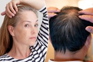 These 2 drinks things can make you go gray and bald