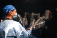 ISSSTE inicia programa de Cirugía Robótica, con dos exitosas intervenciones en Saltillo 