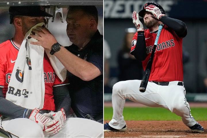 El horrible pelotazo que se llevó David Fry de los Cleveland Guardians