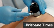Free online tool could save lives from cancer
