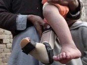 Sindh reports two new polio cases, nationwide tally climbs to 29