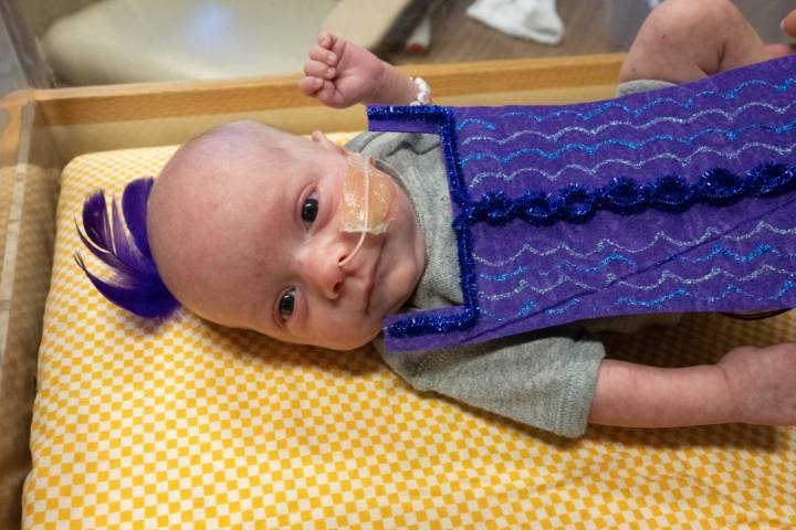 Bringing joy! The tiniest Taylor Swift fans at Akron Children's Hospital await her new record