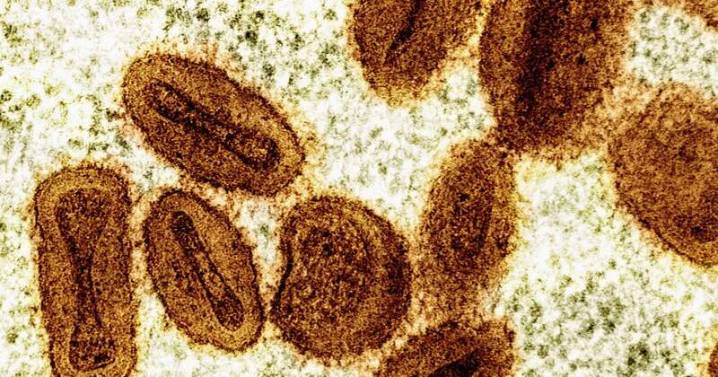 Mpox no longer an international health emergency: WHO