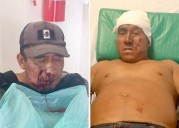Resurge conflicto agrario en la Sierra Sur de #Oaxaca: un muerto y bloqueo carretero entre Zaniza y Amoltepec