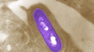 Pasta deli items recalled In Californi over Listeria contamination