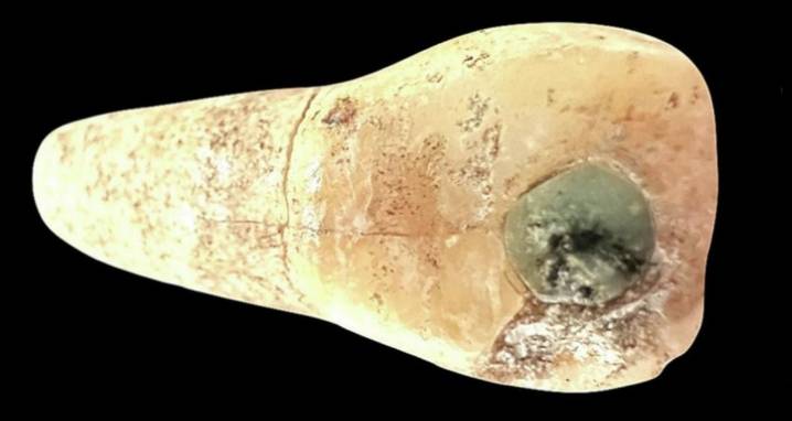 New Study Finds Maya Child Had Jade Tooth Inlays
