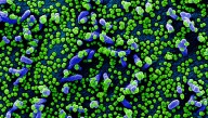 COVID-19 Stratus Variant: What Are The Symptoms?