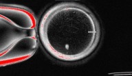 Researchers turn human skin cells into eggs