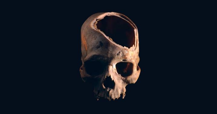 He Died 12,000 Years Ago. Now We Know It Was Murder.