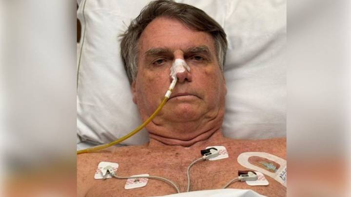 Jair Bolsonaro es diagnosticado con cáncer de piel; le extirpan lesiones cutáneas