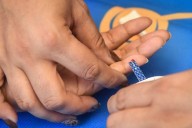 Confirman dos casos de Sarampión en Arandas