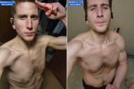 Bryan Kohberger Seen With Fresh Wound in Selfie Taken After Murders