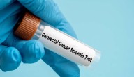 Sugieren que bebidas azucaradas tienen incidencia directa en la propagación del cáncer colorrectal