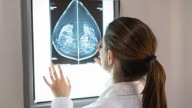 Las mujeres que no se hacen ninguna mamografía tienen más riesgo de morir de cáncer de mama