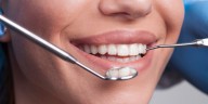 Consejos clave para mantener una boca sana