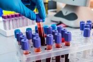 Farmacéuticos y bioquímicos rechazaron proyecto oficial que flexibiliza el control de importados