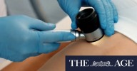 Free online tool could save lives from cancer