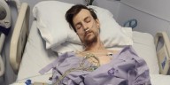 ‘Why did you take off?’: Man loses leg in hit-and-run, searching for person responsible