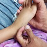 Otro caso de mordedura por serpiente coral en paciente pediátrico es salvado en el Iahula
