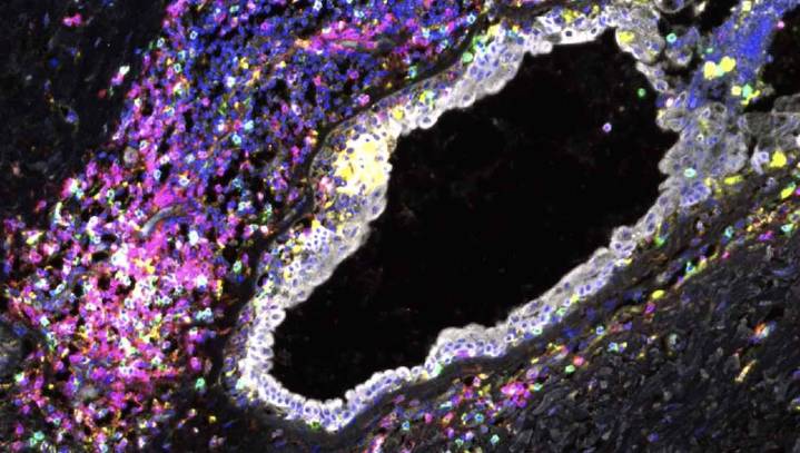 Immune System Can Be Reprogrammed to Heal Body Faster–Jump-Starting it via Electrical Stimulation