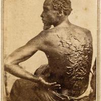 Trump admin to remove scourged back photo of slavery