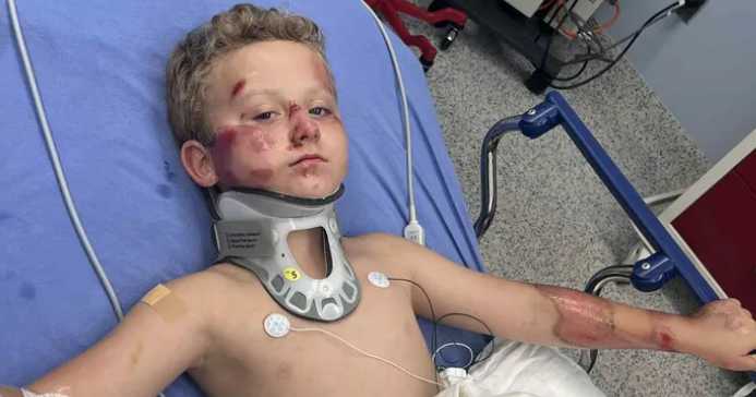 8-year-old boy on bicycle recovering after hit-and-run in Fort Worth: "He was covered in blood," mom says.