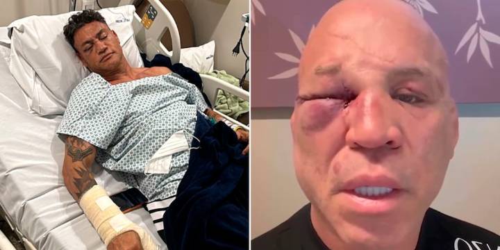 Fracturas, declaraciones cruzadas y polémica: las secuelas que dejó la batalla campal durante una pelea de boxeo en Brasil