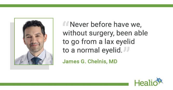 Noninvasive OptiLift addresses ‘root cause’ of dry eye