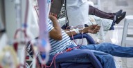 Guidance Issued for Creation of pAVFs for Hemodialysis Access