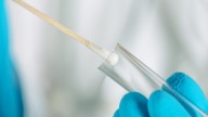 Un gallego logra una herencia millonaria tras probar su filiación gracias a un escupitajo