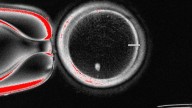 Scientists create eggs from human skin cells, though not usable yet