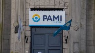 Descubren que PAMI paga sobreprecios de hasta el 1.000 % por lentes para cirugías de cataratas