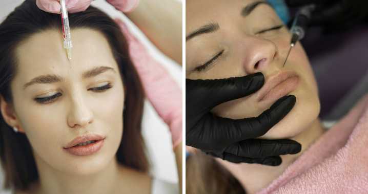 ¿Una moda peligrosa? Los riesgos poco conocidos de inyectarse ácido hialurónico y bioestimuladores