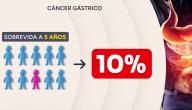 Cáncer gástrico: Ojo con la indigestión en Fiestas Patrias