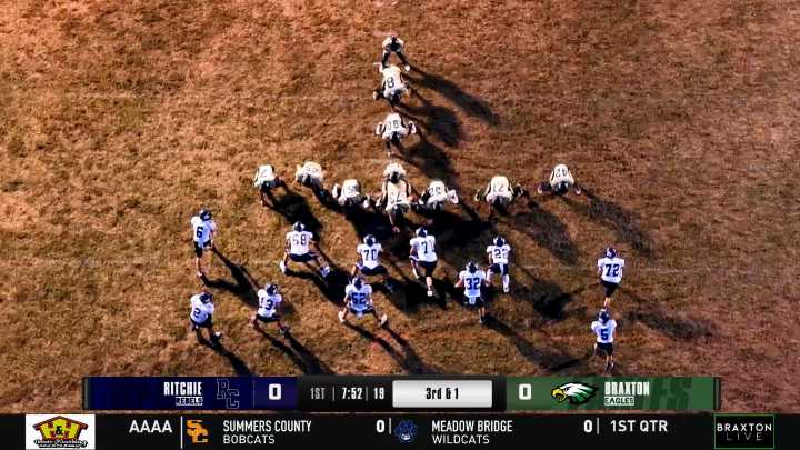 Highlights: Braxton defeats Ritchie, 16