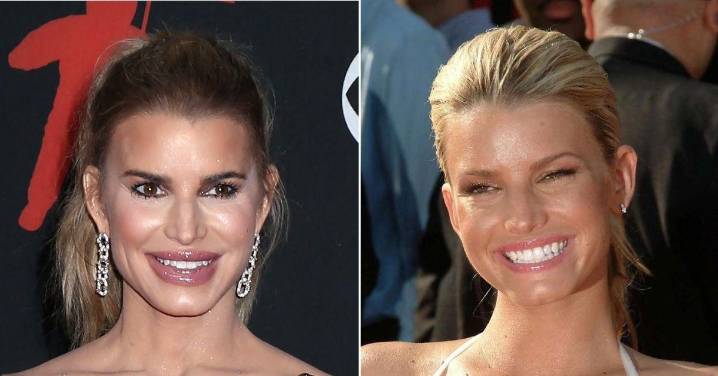 Plastic Surgeon Reveal Secrets Behind Jessica Simpson's New Face