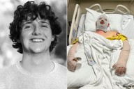 Student Suffers ‘Catastrophic’ Burns After Hit by Alleged Drunk Driver En Route to Campus