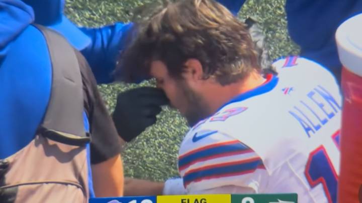 Josh Allen sparks concern as Buffalo Bills star QB bleeding from his NOSE after hit by New York Jets defender